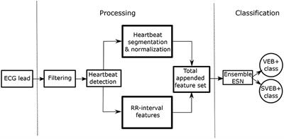 A Fast Machine Learning Model for ECG-Based Heartbeat Classification and Arrhythmia Detection